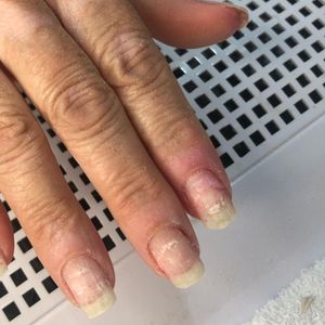 imagem do produto Remoção do alongamento 